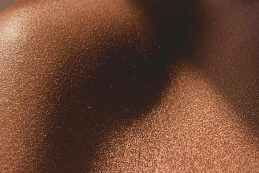 Peau foncée à imperfections : les meilleures astuces pour une peau sublime