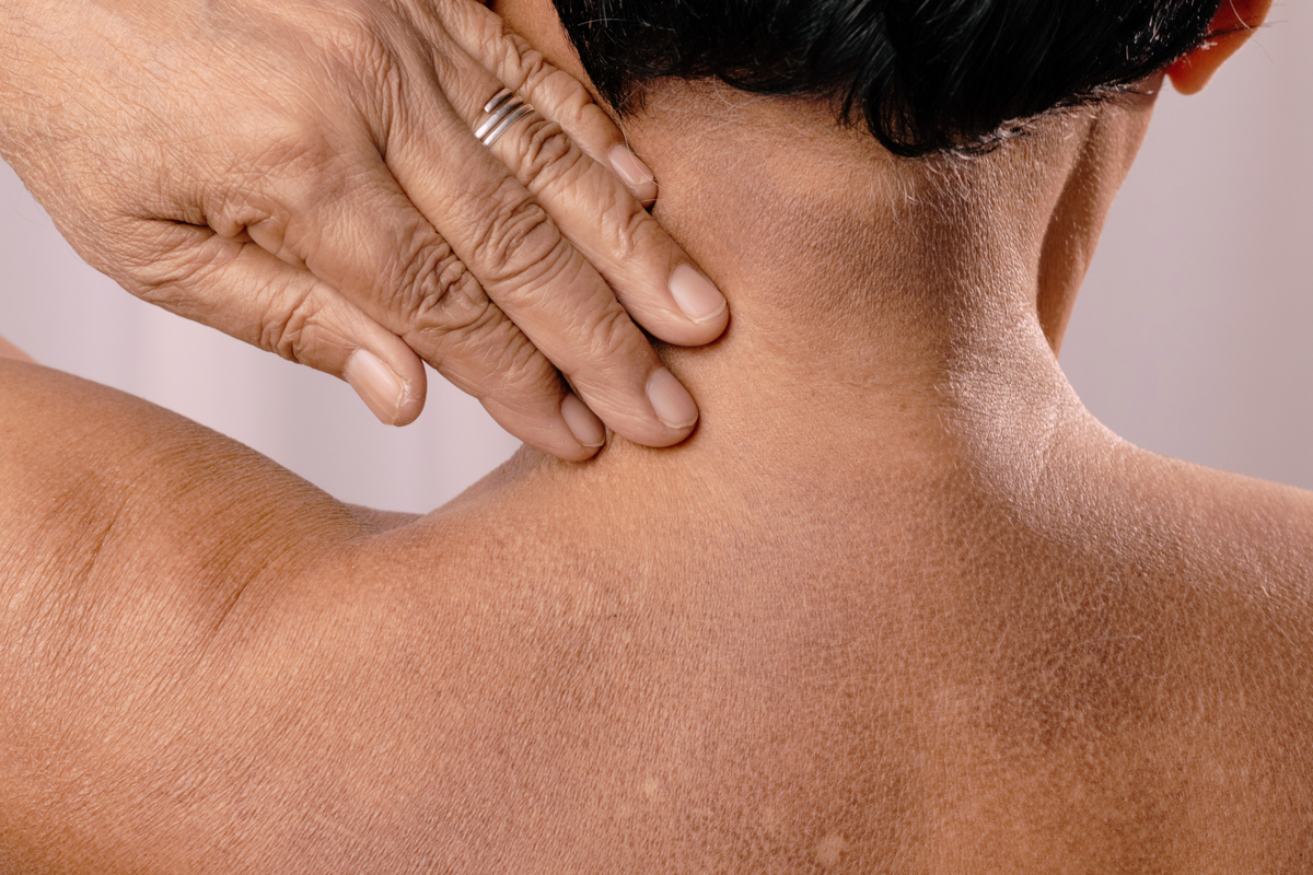Peaux noires sujettes à l’eczéma : quels soins privilégier ?