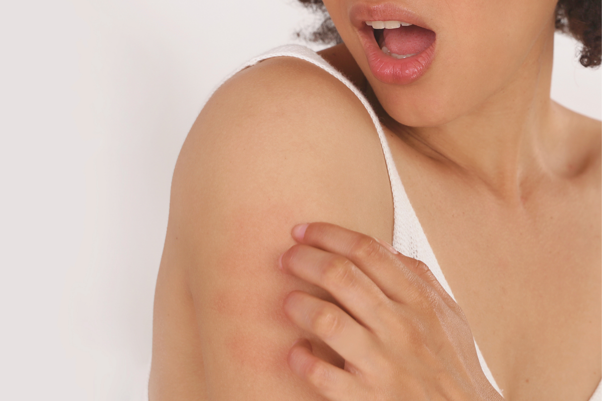Barrière cutanée fragilisée sur peau mate : comment la renforcer ?