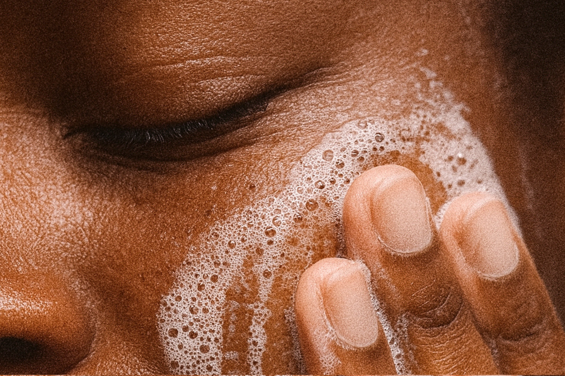 Pourquoi les peaux foncées marquent-elles plus facilement ?