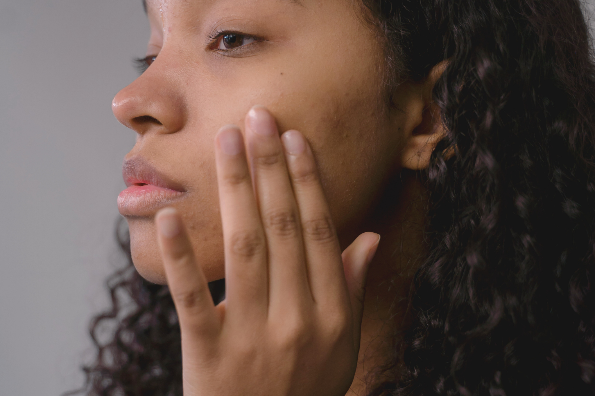 Une femme femme métisse aux cheveux bouclés touche ses petits boutons sur la joue gauche.