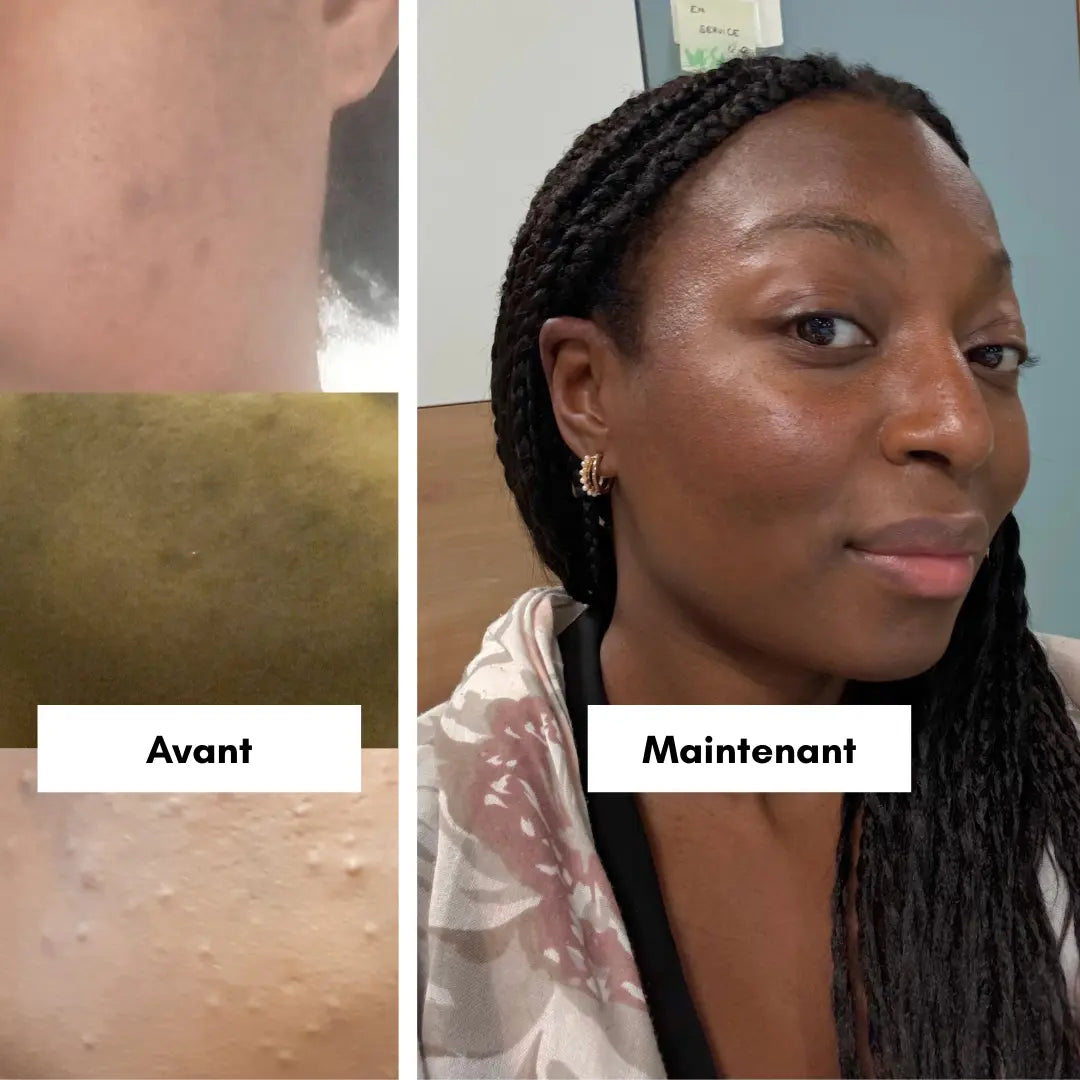 Photos avant et après l'utilisation des soins Mawu Paris.